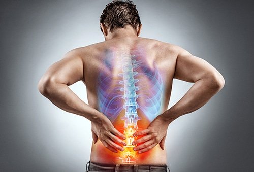 Physiotherapist assessing a patient with sciatica.